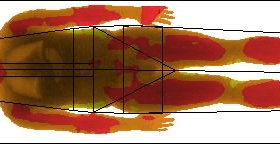 heat map of body